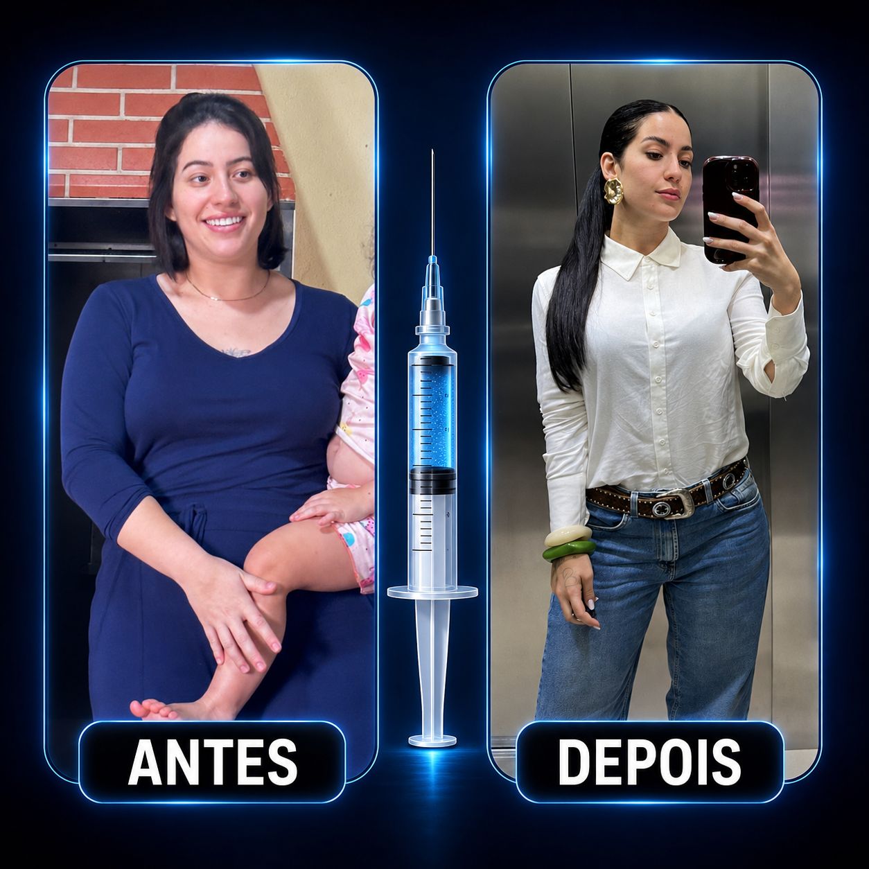 Resultado real de paciente — antes e depois do tratamento de emagrecimento com o Dr. Alexandre Henrique Jr